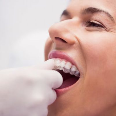 How Does Invisalign Bridge Cosmetic and Traditional Dentistry